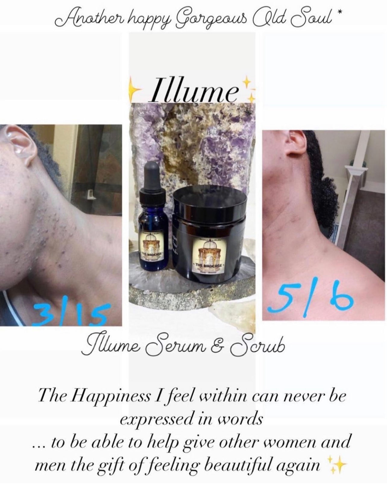 Illume* Serum & Scrub ~ Dark Spot Diminishing Treatment ~ Essential Oils ~ All Natural ~ Mother Nature's Dark Spot Treatment